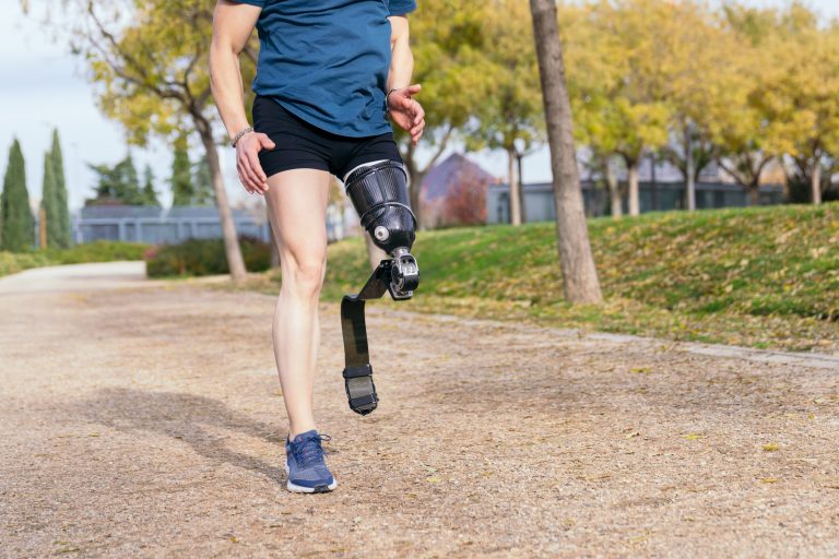 male runner with prosthetic